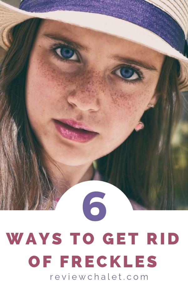 If you wonder how to get rid of freckles, you'll love these 6 easy ways! #freckles #naturalbeauty #fairskin #fairsskinnedface #prettyface #agespots #beauty #beautiful